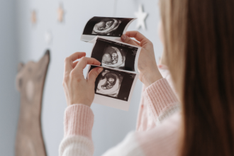 A Dra. Thaline Neves revela como o ultrassom 3D oferece imagens mais detalhadas e aplicações práticas inovadoras na medicina fetal.